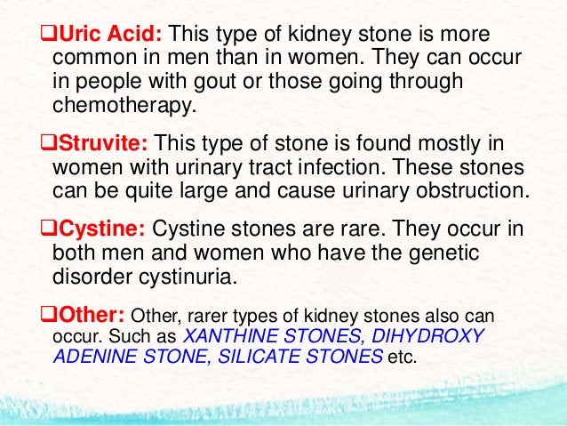 What are some of the known causes of kidney stones?