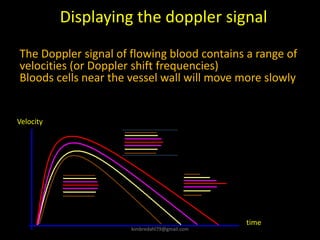 The Doppler signal of flowing blood contains a range of
velocities (or Doppler shift frequencies)
Bloods cells near the vessel wall will move more slowly
Displaying the doppler signal
Velocity
time
kimbredahl79@gmail.com
 