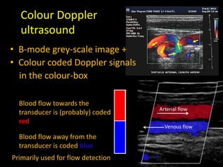 Colour Doppler
ultrasound
• B-mode grey-scale image +
• Colour coded Doppler signals
in the colour-box
Blood flow towards the
transducer is (probably) coded
red
Blood flow away from the
transducer is coded blue
Arterial flow
Venous flow
Primarily used for flow detection
 