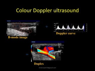 Colour Doppler ultrasound
B-mode image
+
Doppler curve
=
Duplex
kimbredahl79@gmail.com
 