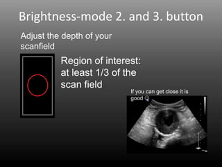 Brightness-mode 2. and 3. button
Adjust the depth of your
scanfield
Region of interest:
at least 1/3 of the
scan field
If you can get close it is
good ☺
 