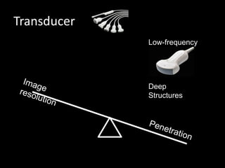 Transducer
Low-frequency
Deep
Structures
 