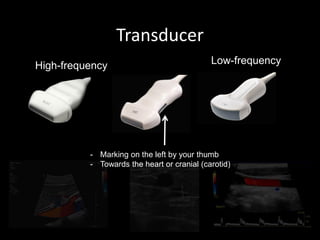 Transducer
High-frequency Low-frequency
- Marking on the left by your thumb
- Towards the heart or cranial (carotid)
 