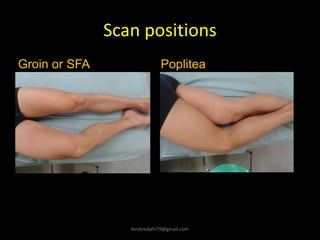 Scan positions
kimbredahl79@gmail.com
Groin or SFA Poplitea
 