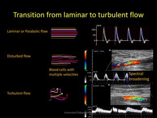 Transition from laminar to turbulent flow
Blood cells with
multiple velocities Spectral
broadening
Laminar or Parabolic flow
Disturbed flow
Turbulent flow
kimbredahl79@gmail.com
 