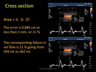 Cross section
The error is 0.084 cm or
less than 1 mm. or 11 %
Area = π . ¼ . D²
The corresponding failure in
vol flow is 21 % going from
459 mL to 362 mL
kimbredahl79@gmail.com
 