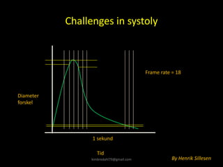 Challenges in systoly
Diameter
forskel
Tid
1 sekund
Frame rate = 18
By Henrik Sillesen
kimbredahl79@gmail.com
 