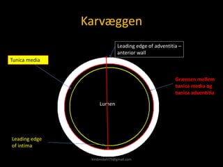 Karvæggen
Leading edge
of intima
Tunica media
Leading edge of adventitia –
anterior wall
Lumen
Grænsen mellem
tunica media og
tunica adventitia
kimbredahl79@gmail.com
 