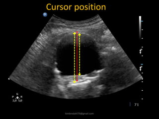 Cursor position
kimbredahl79@gmail.com
 