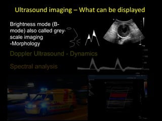 Ultrasound imaging – What can be displayed
Brightness mode (B-
mode) also called grey-
scale imaging
-Morphology
Colour
Spectral analysis
Doppler Ultrasound - Dynamics
 