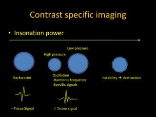 Contrast specific imaging
• Insonation power
Instability → destruction
Backscatter
= Tissue Signal
Low pressure
High pressure
Oscillation
-Harmonic frequency
-Specific signals
≠ Tissue signal
 