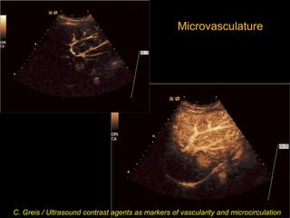 Microvasculature
C. Greis / Ultrasound contrast agents as markers of vascularity and microcirculation
 
