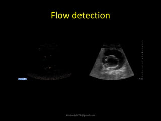 Flow detection
kimbredahl79@gmail.com
 