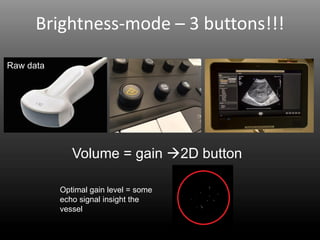 Brightness-mode – 3 buttons!!!
Raw data
Volume = gain →2D button
Optimal gain level = some
echo signal insight the
vessel
 