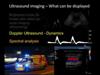 Ultrasound imaging – What can be displayed
Brightness mode (B-
mode) also called grey-
scale imaging
-Morphology
Colour
Spectral analysis
Doppler Ultrasound - Dynamics
 