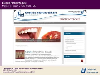 Blog de Parodontologie
Mokbel N / Bazan S FMD–UNTE - USJ
 