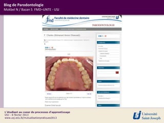 Blog de Parodontologie
Mokbel N / Bazan S FMD–UNTE - USJ
 