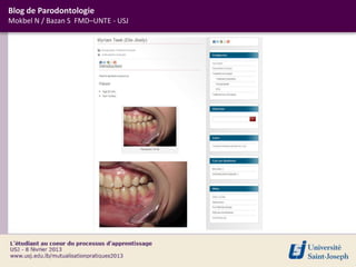 Blog de Parodontologie
Mokbel N / Bazan S FMD–UNTE - USJ
 