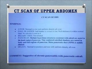 Ct sCan of upper abdomen
 