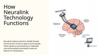 Presentation - Neuralink Bridging Brain and Machine.pptx