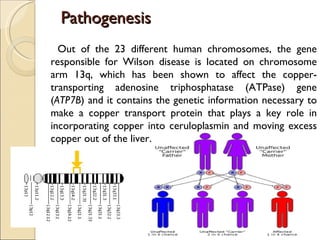 Pathogenesis
  Out of the 23 different human chromosomes, the gene
responsible for Wilson disease is located on chromosome
arm 13q, which has been shown to affect the copper-
transporting adenosine triphosphatase (ATPase) gene
(ATP7B) and it contains the genetic information necessary to
make a copper transport protein that plays a key role in
incorporating copper into ceruloplasmin and moving excess
copper out of the liver.
 