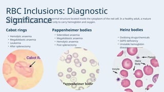 G6pd Deficiency Rbc Inclusions Comprehensive Guide to Peripheral Blood Smear in Diagnostic Hematology ...