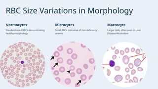Presentation - PERIPHERAL BLOOD SMEAR AND MORPHOLOGICAL EVALUATION OF ...