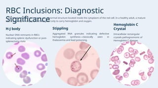 Radioactive Rbcs Presentation - PERIPHERAL BLOOD SMEAR AND MORPHOLOGICAL EVALUATION OF ...