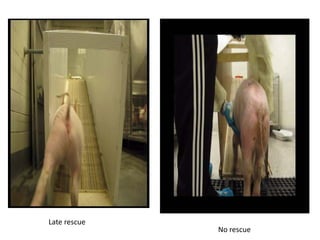 Late rescue
No rescue
 