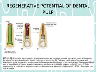 Pulp Caries Pulpal Reactions to Dental Caries and Dental Proceudres | PPTX