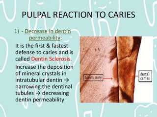 1. PULPAL REACTION TO CARIES
2) - Tertiary dentin formation:
It is not the most effective pulpally mediated
defense.
MECHA...