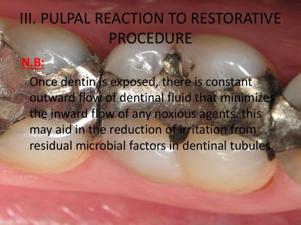 Pulpal Reactions to Dental Caries and Dental Proceudres