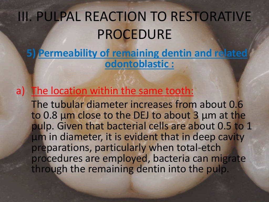 Pulpal Reactions to Dental Caries and Dental Proceudres