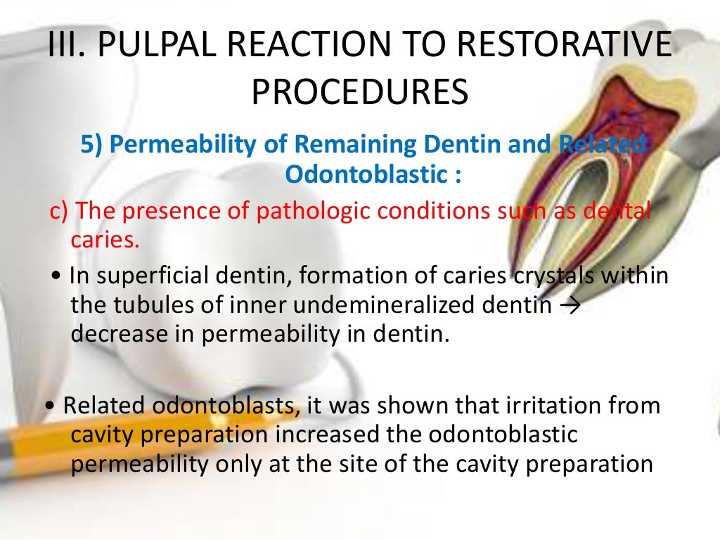 Pulpal Reactions to Dental Caries and Dental Proceudres