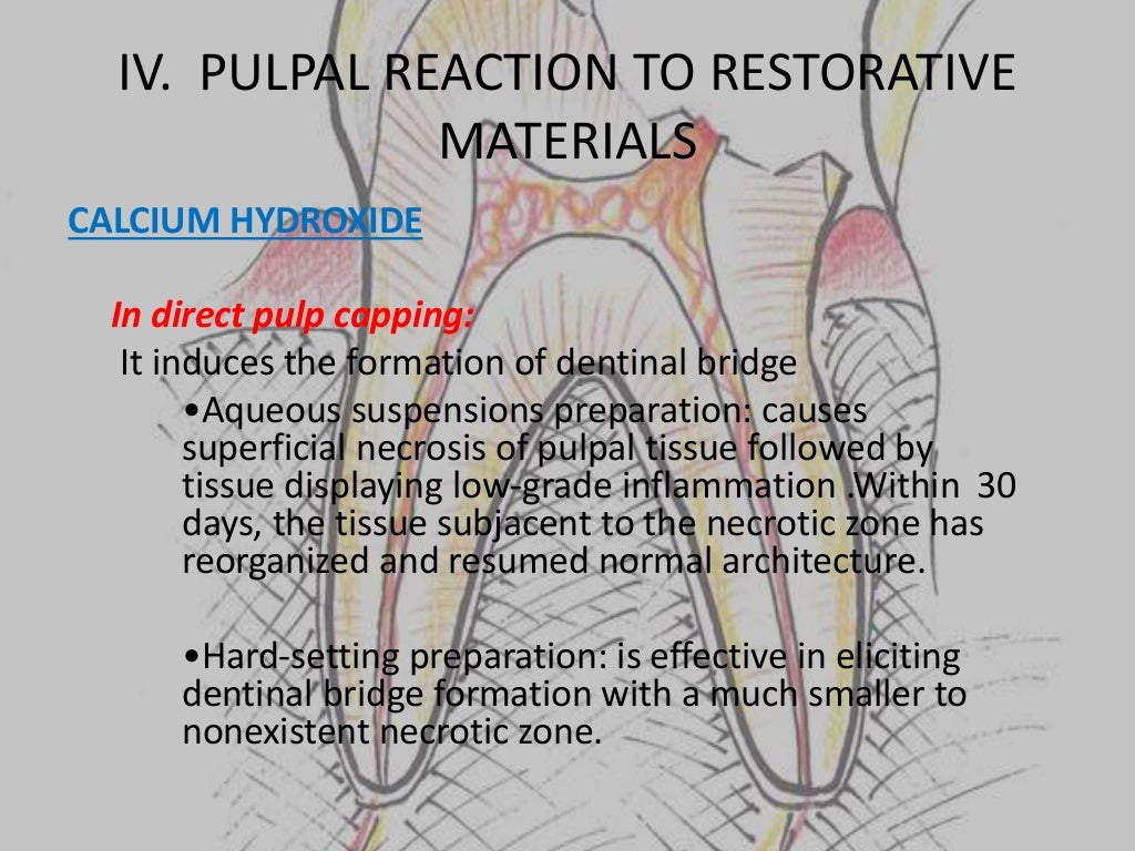 Pulpal Reactions to Dental Caries and Dental Proceudres