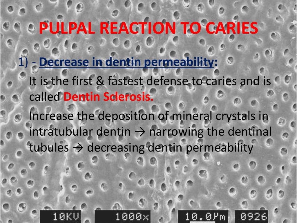 Pulpal Reactions to Dental Caries and Dental Proceudres