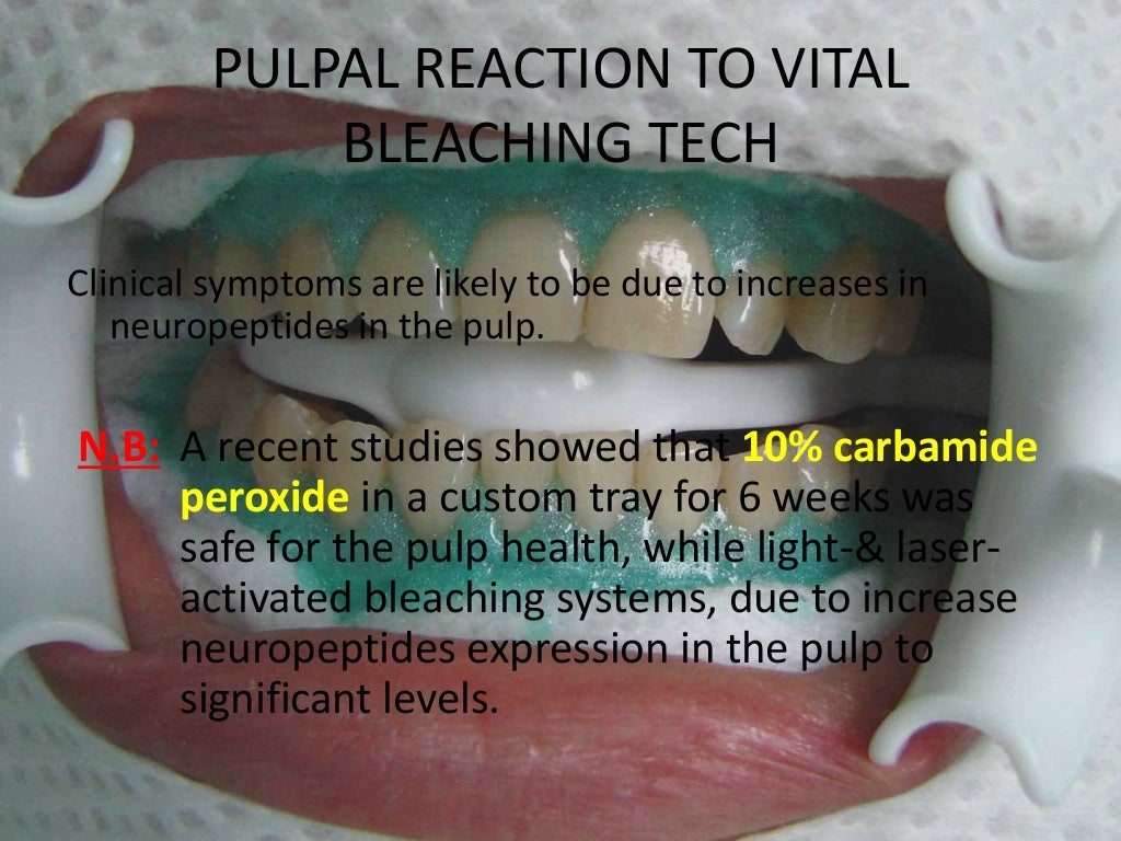 Pulpal Reactions to Dental Caries and Dental Proceudres