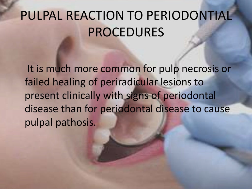 Pulpal Reactions to Dental Caries and Dental Proceudres