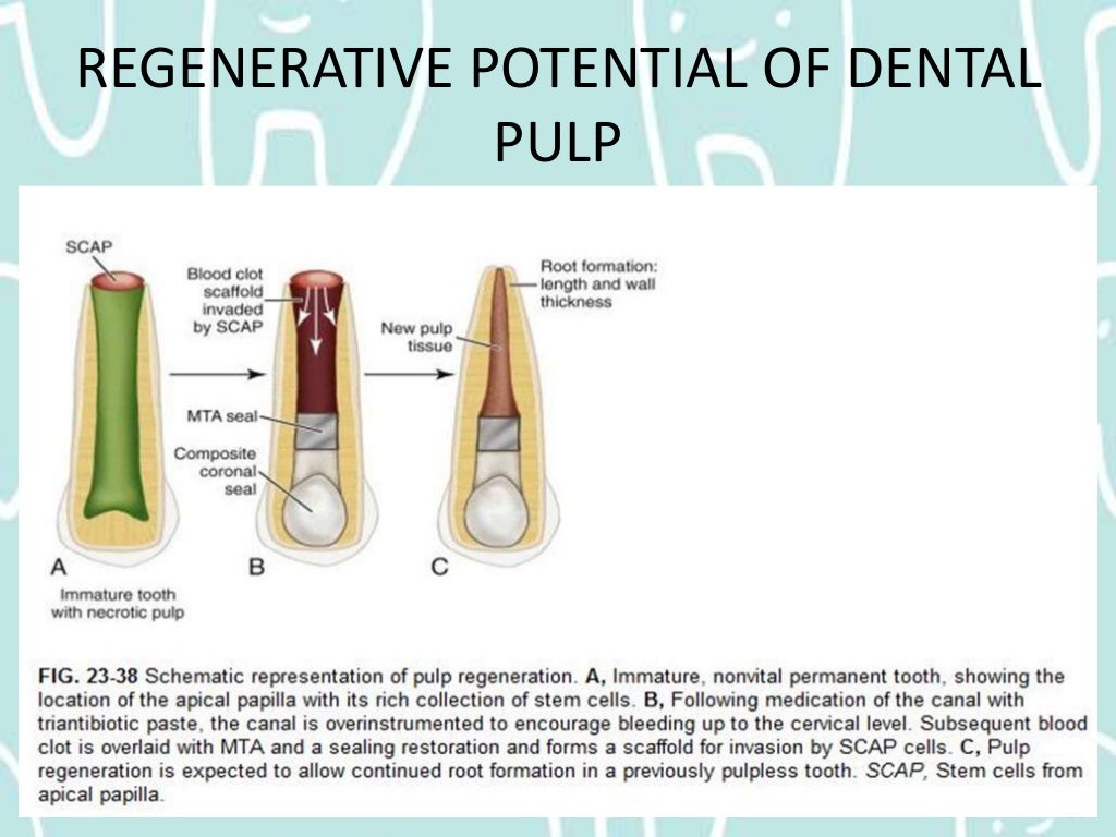 Pulpal Reactions to Dental Caries and Dental Proceudres