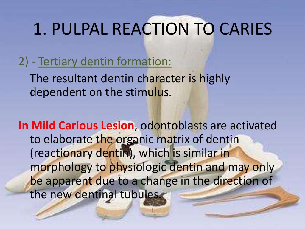 Pulpal Reactions to Dental Caries and Dental Proceudres