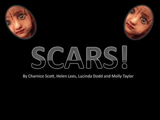 SCARS! By Charnice Scott, Helen Lees, Lucinda Dodd and Molly Taylor 
