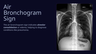 Presentation - Special Views & Signs.pptx