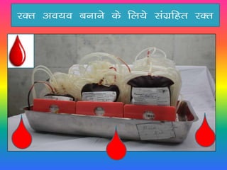 jDr vo;o cukus ds fy;s laxzfgr jDr
 