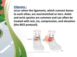 2)Sprains :
occur when the ligaments, which connect bones
to each other, are overstretched or torn. Ankle
and wrist sprains are common and can often be
treated with rest, ice, compression, and elevation
(the RICE protocol).
 