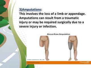 3)Amputations:
This involves the loss of a limb or appendage.
Amputations can result from a traumatic
injury or may be required surgically due to a
severe injury or infection.
 