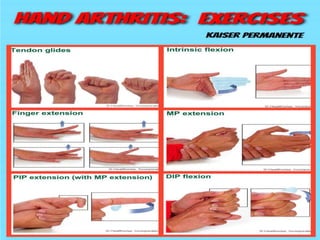 physical therapy treatment for ARTHRITIS | PPTX