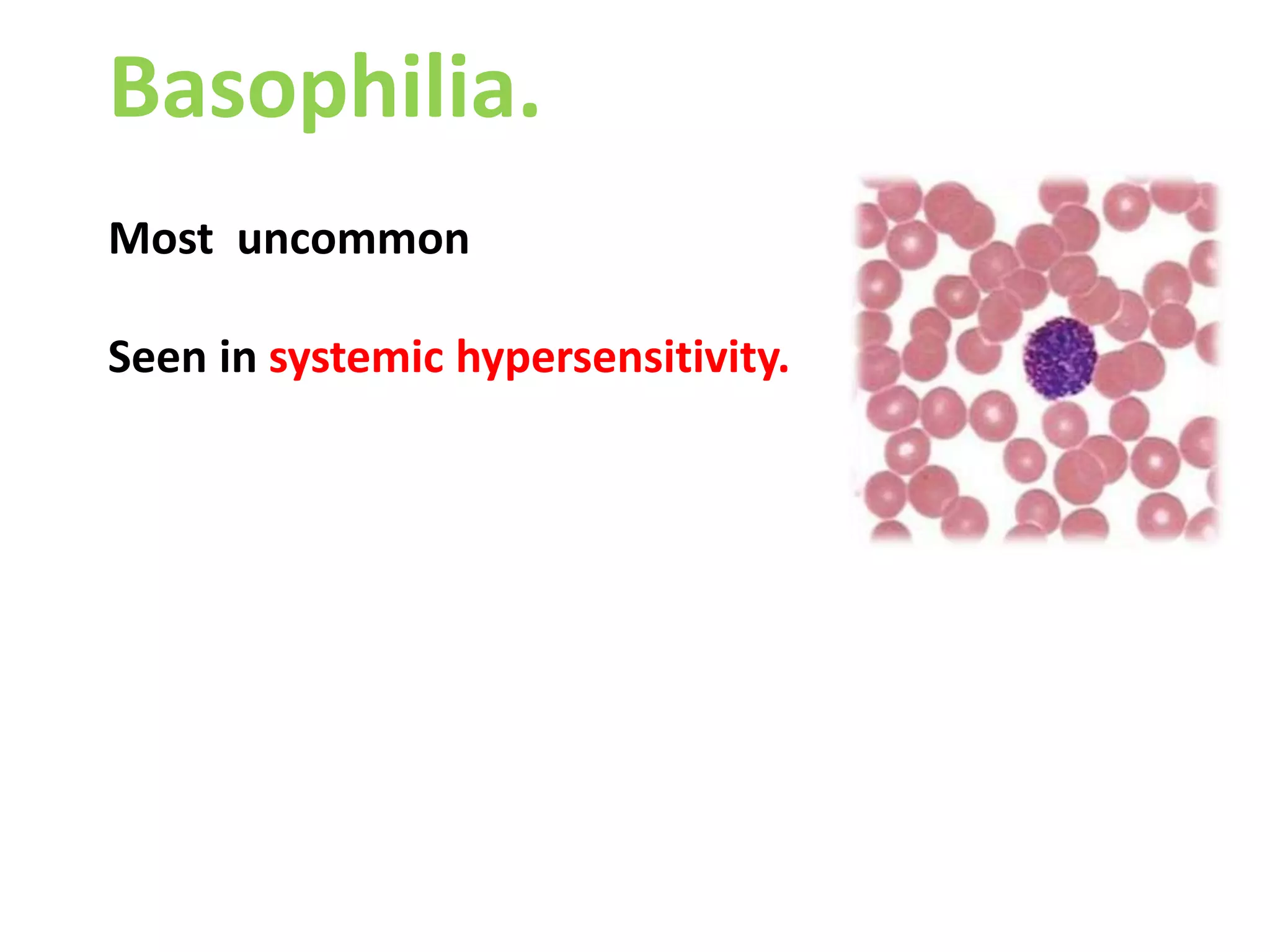 Basophilia. 
Most uncommon 
Seen in systemic hypersensitivity. 
 