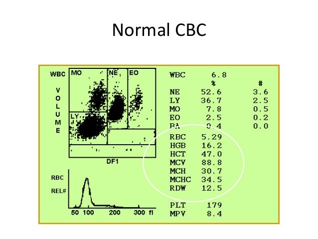 Polycythemia Vera Will Result In
