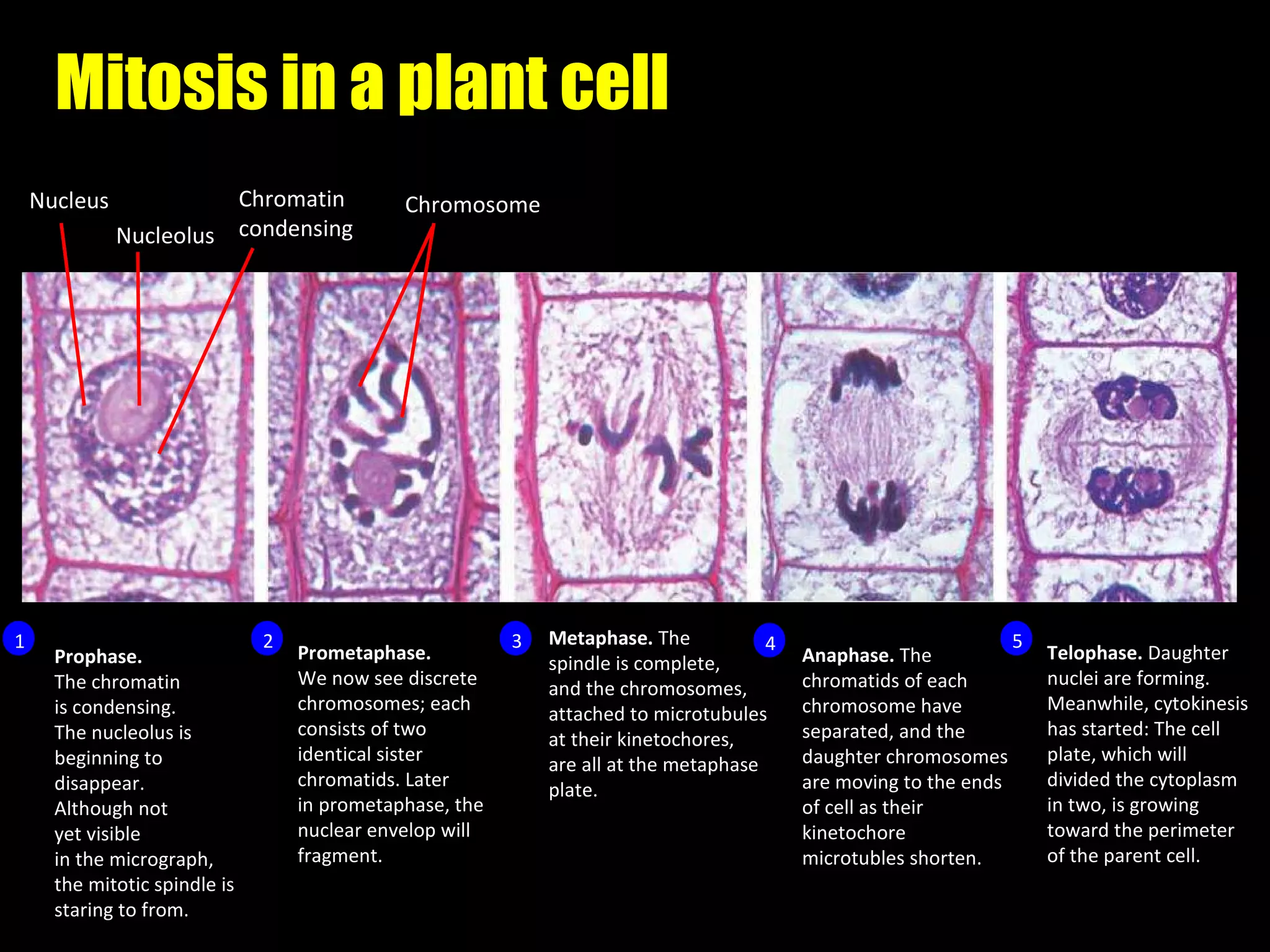 Mitosis in a plant cell 1 Prophase.  The chromatin is condensing.  The nucleolus is  beginning to  disappear. Although not  yet visible  in the micrograph,  the mitotic spindle is  staring to from. Prometaphase. We now see discrete chromosomes; each  consists of two  identical sister  chromatids. Later in prometaphase, the  nuclear envelop will  fragment. Metaphase.  The  spindle is complete, and the chromosomes, attached to microtubules at their kinetochores,  are all at the metaphase  plate. Anaphase.  The chromatids of each  chromosome have  separated, and the  daughter chromosomes are moving to the ends  of cell as their  kinetochore microtubles shorten. Telophase.  Daughter nuclei are forming.  Meanwhile, cytokinesis has started: The cell plate, which will  divided the cytoplasm  in two, is growing  toward the perimeter   of the parent cell. 2 3 4 5 Nucleus Nucleolus Chromosome Chromatin condensing 