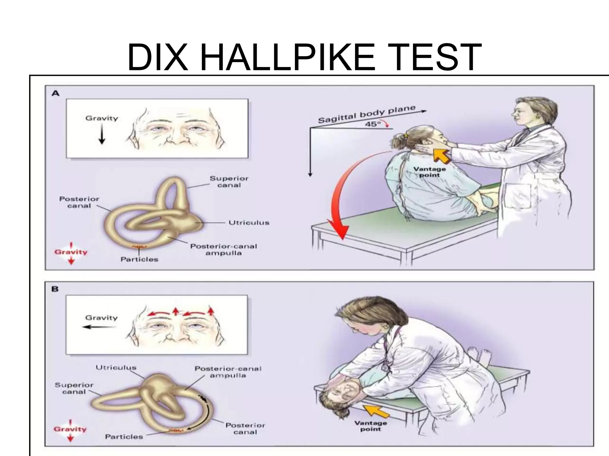 Presentation01mhb vestibular rehab | PPT